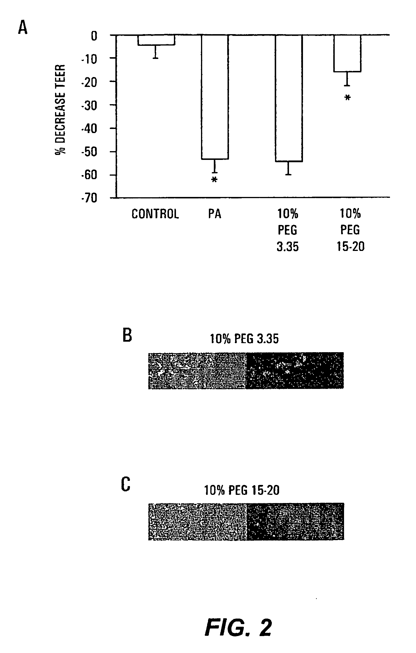 Therapeutic Delivery System Comprising a High Molecular Weight Peg-Like Compound