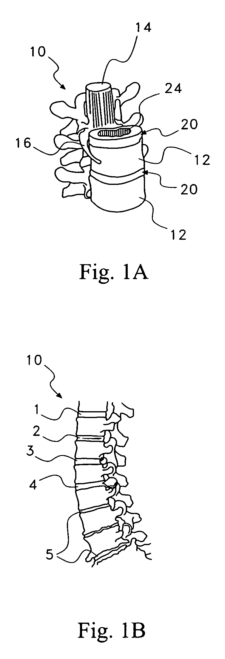 Methods for treating back or neck pain caused by NGF using a therapeutic agent consisting of ReN-1820, ALE-0540 and capsaicin