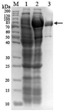 Chondrosulphatase B as well as coding gene and construction method thereof