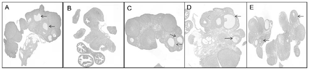 Traditional Chinese medicine composition for treating or improving polycystic ovarian syndrome as well as preparation method and application thereof