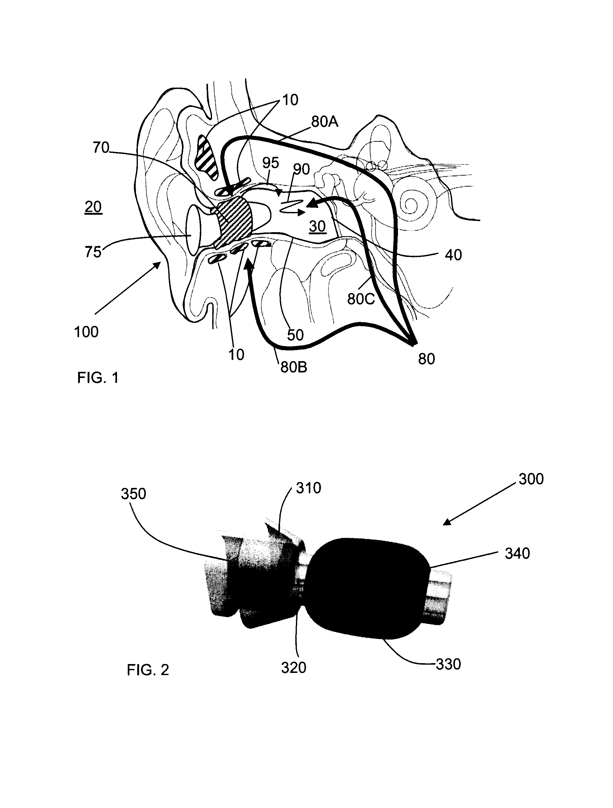 Pressure regulating systems for expandable insertion devices