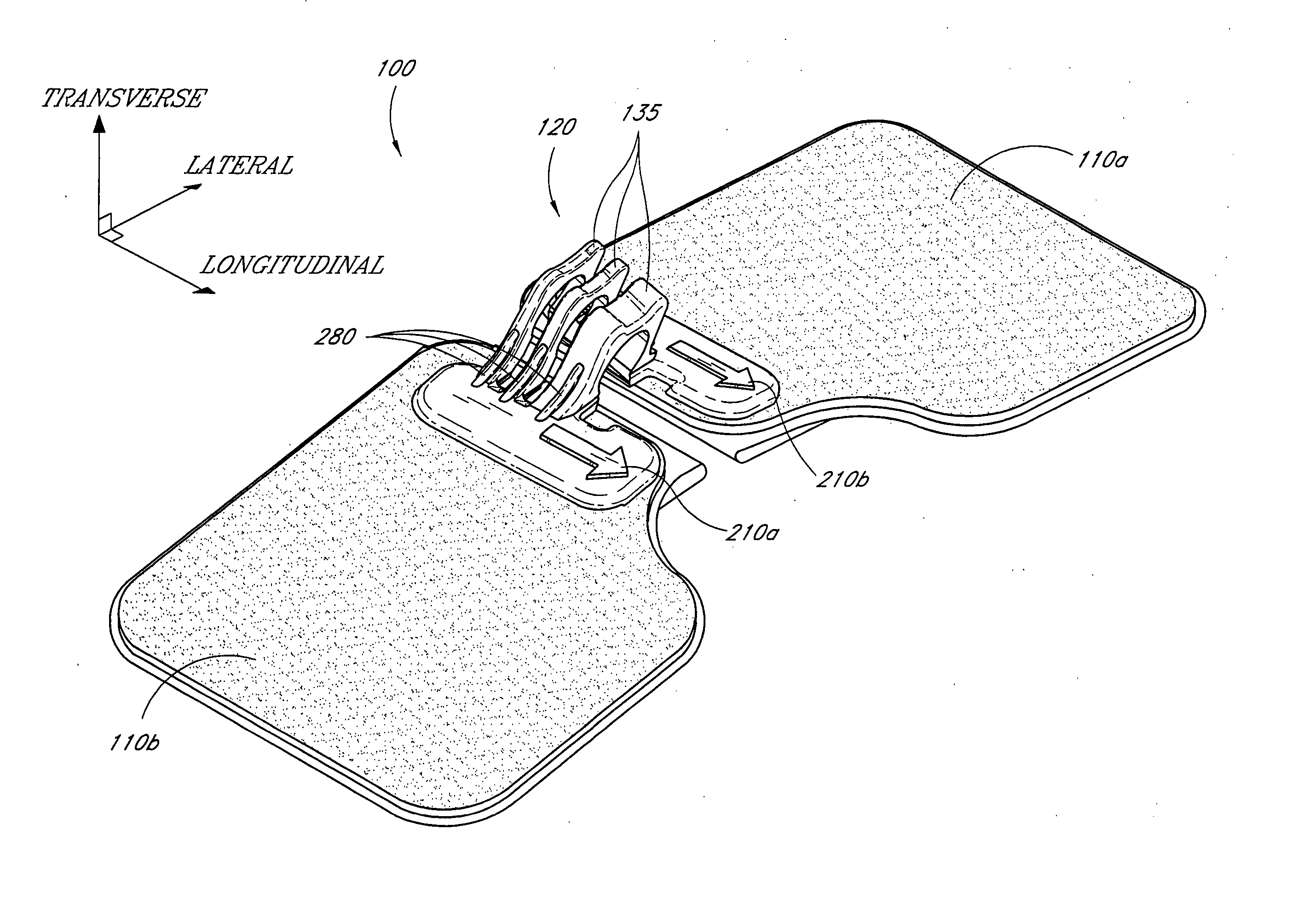 Catheter securement device