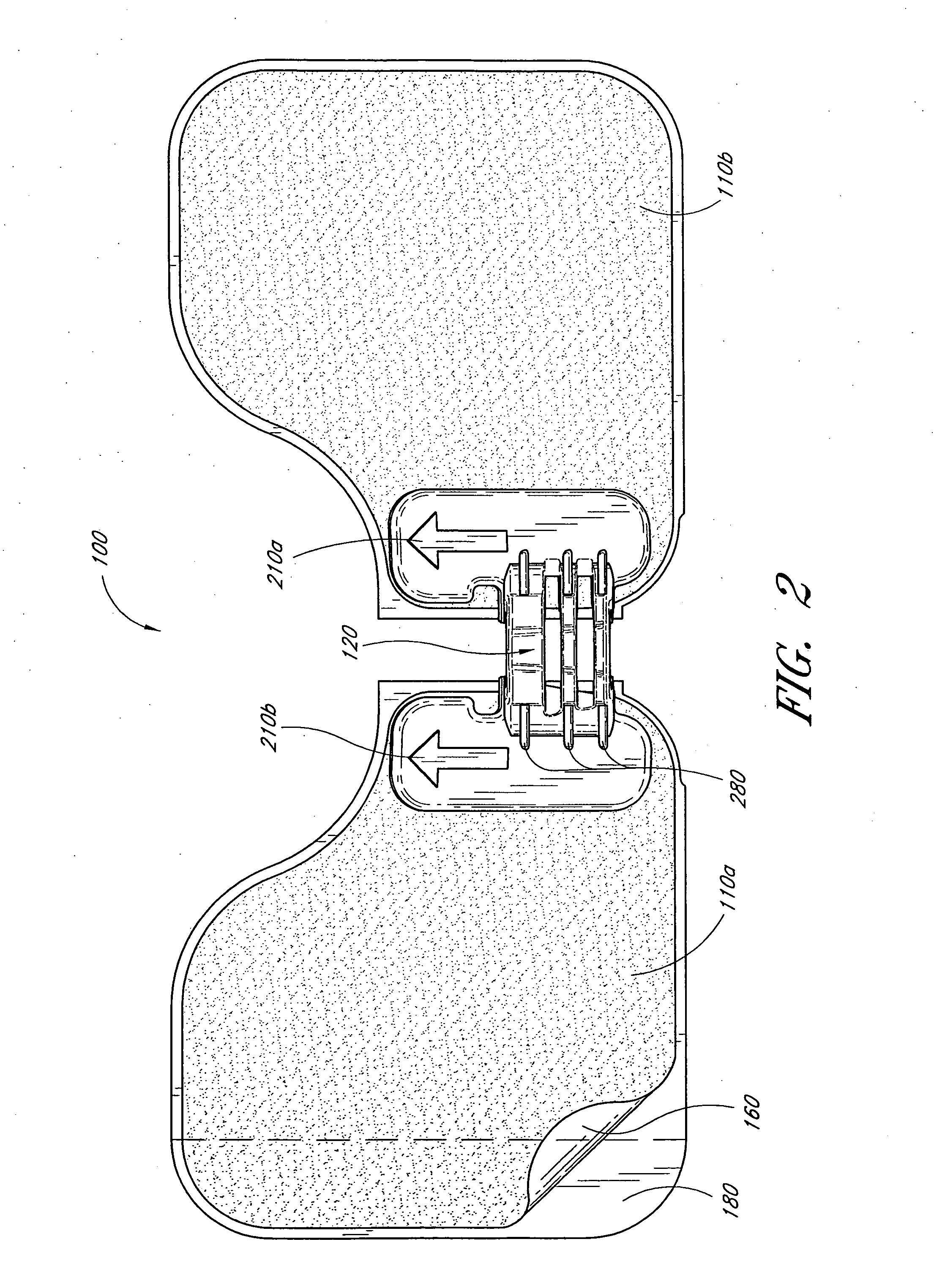 Catheter securement device