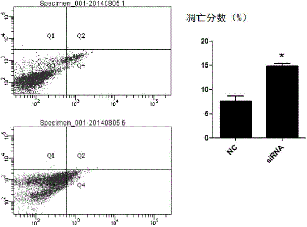 Application of long-chain non-coding RNA molecule SNHG18 in preparing medicine for treating brain glioma