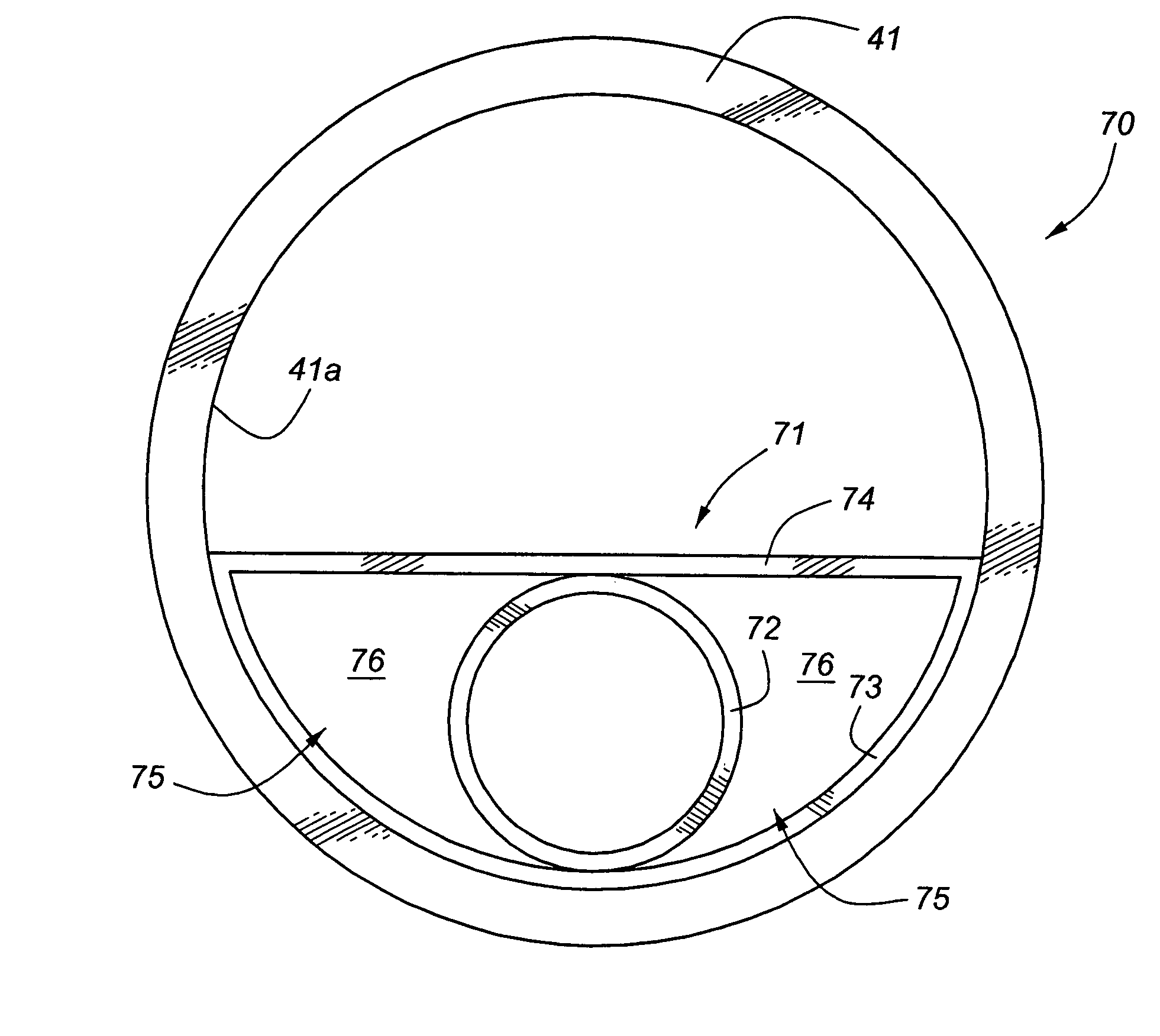 Separated sanitary and storm sewer system