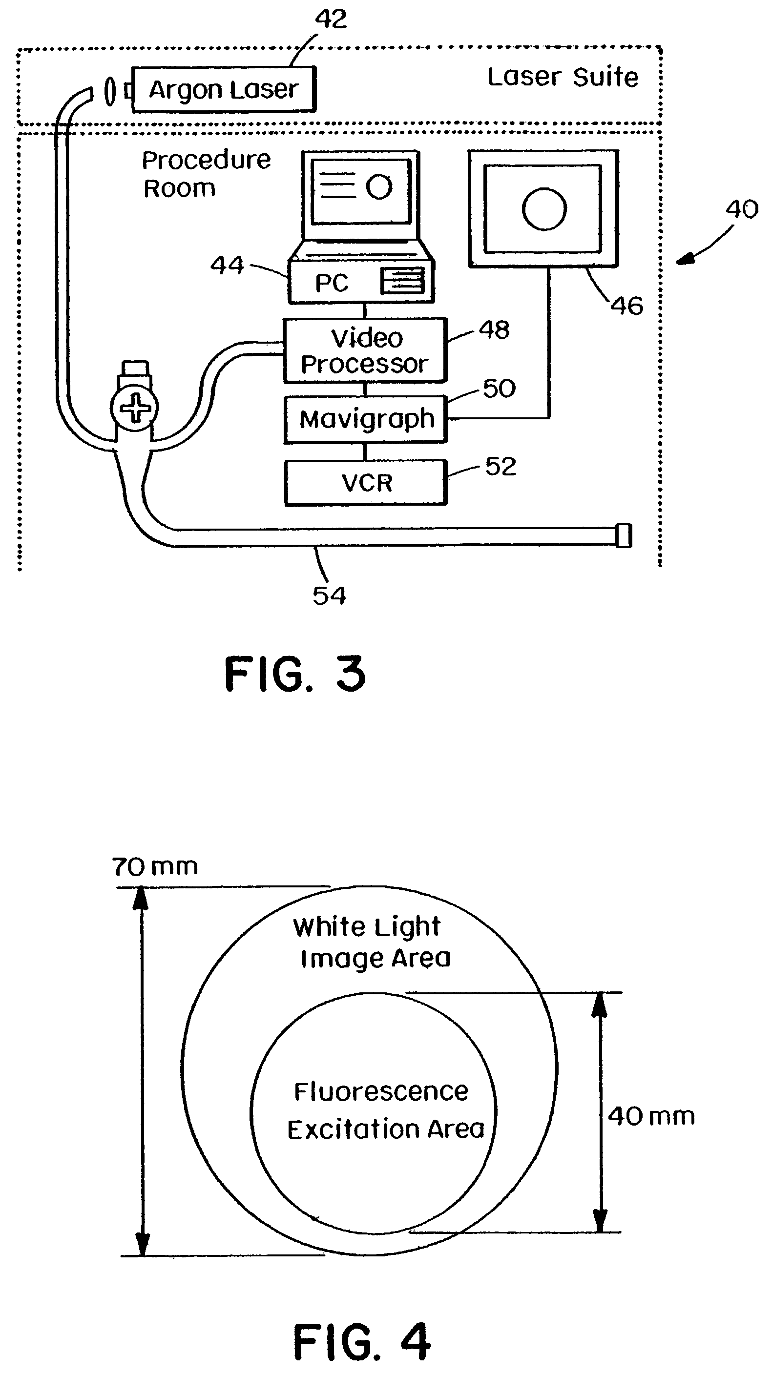 Fluorescence imaging endoscope