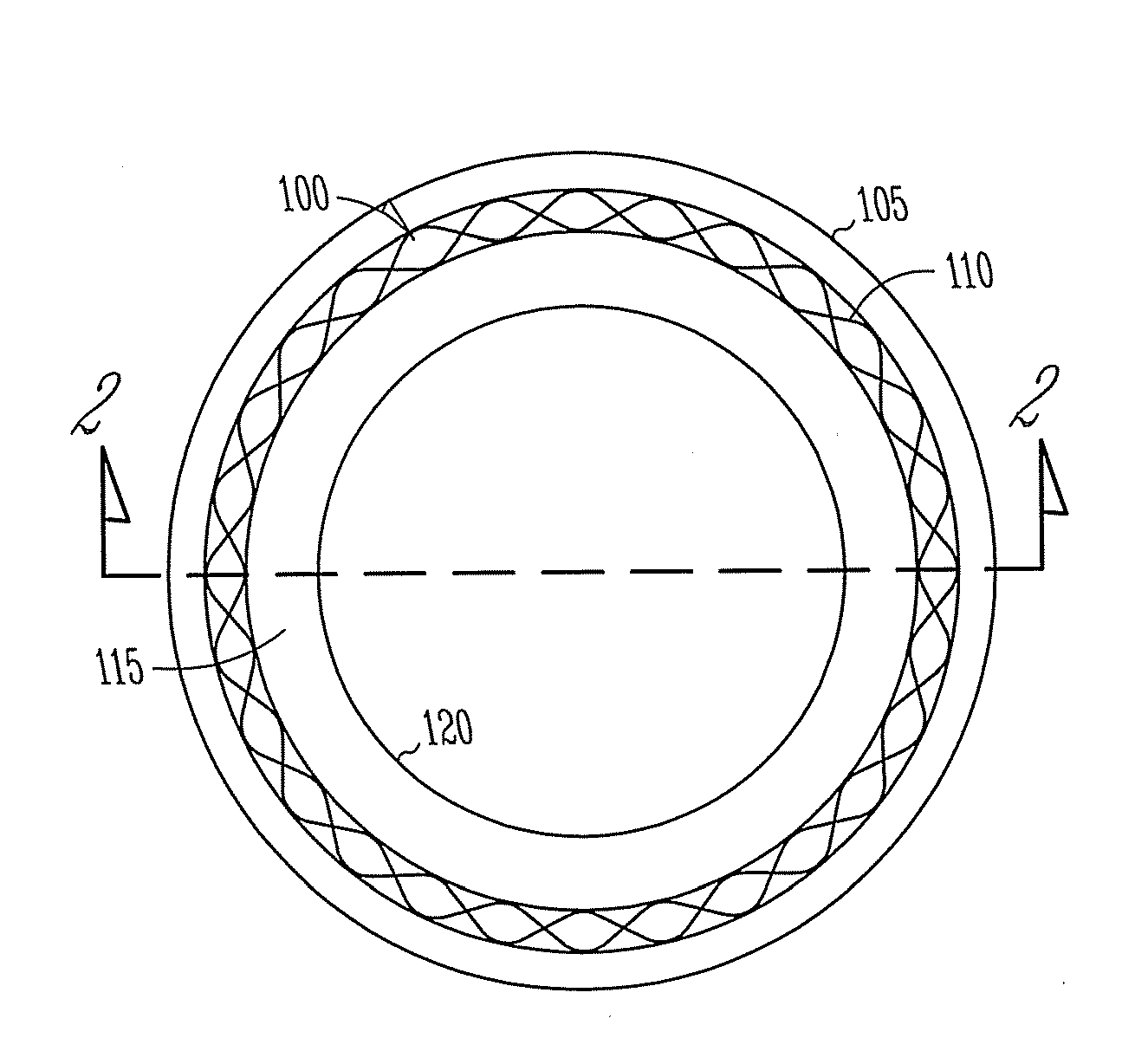 Vascular elastance