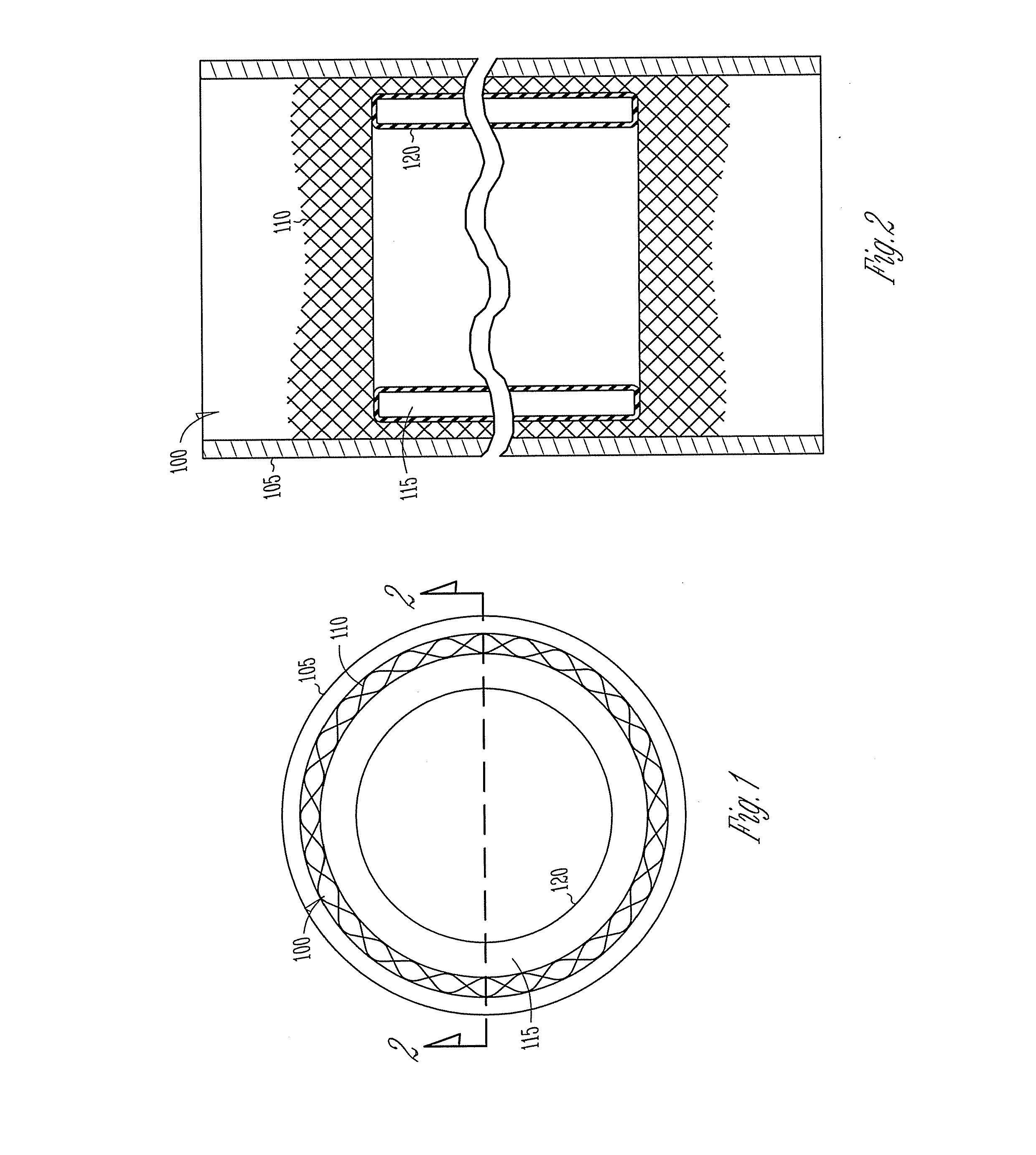 Vascular elastance