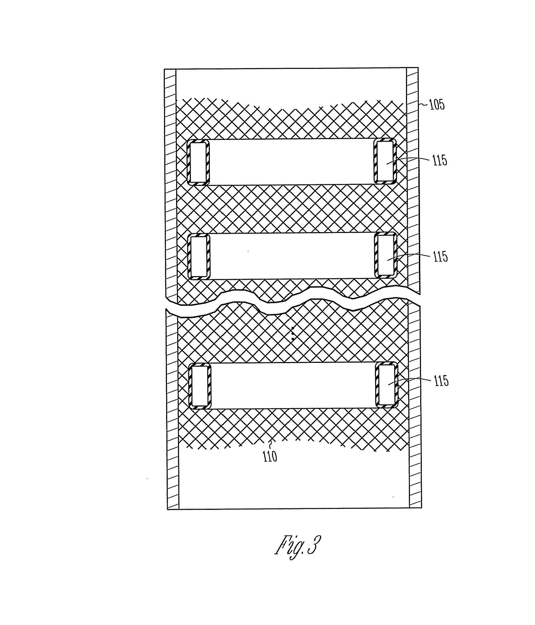 Vascular elastance