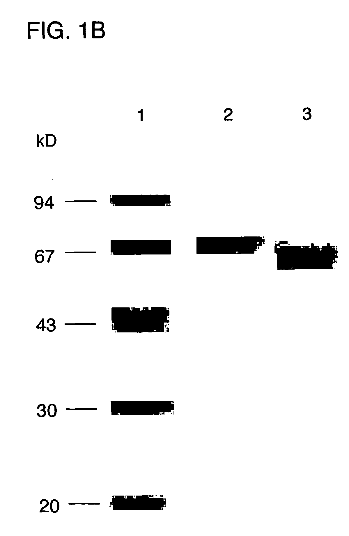 Recombinant human alpha-fetoprotein as an immunosuppressive agent