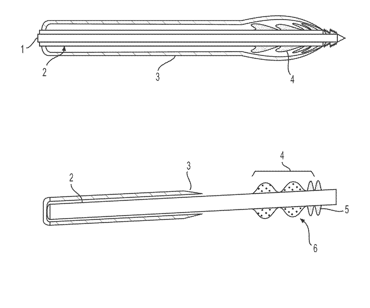 Devices and methods for treating occlusion of the ophthalmic artery