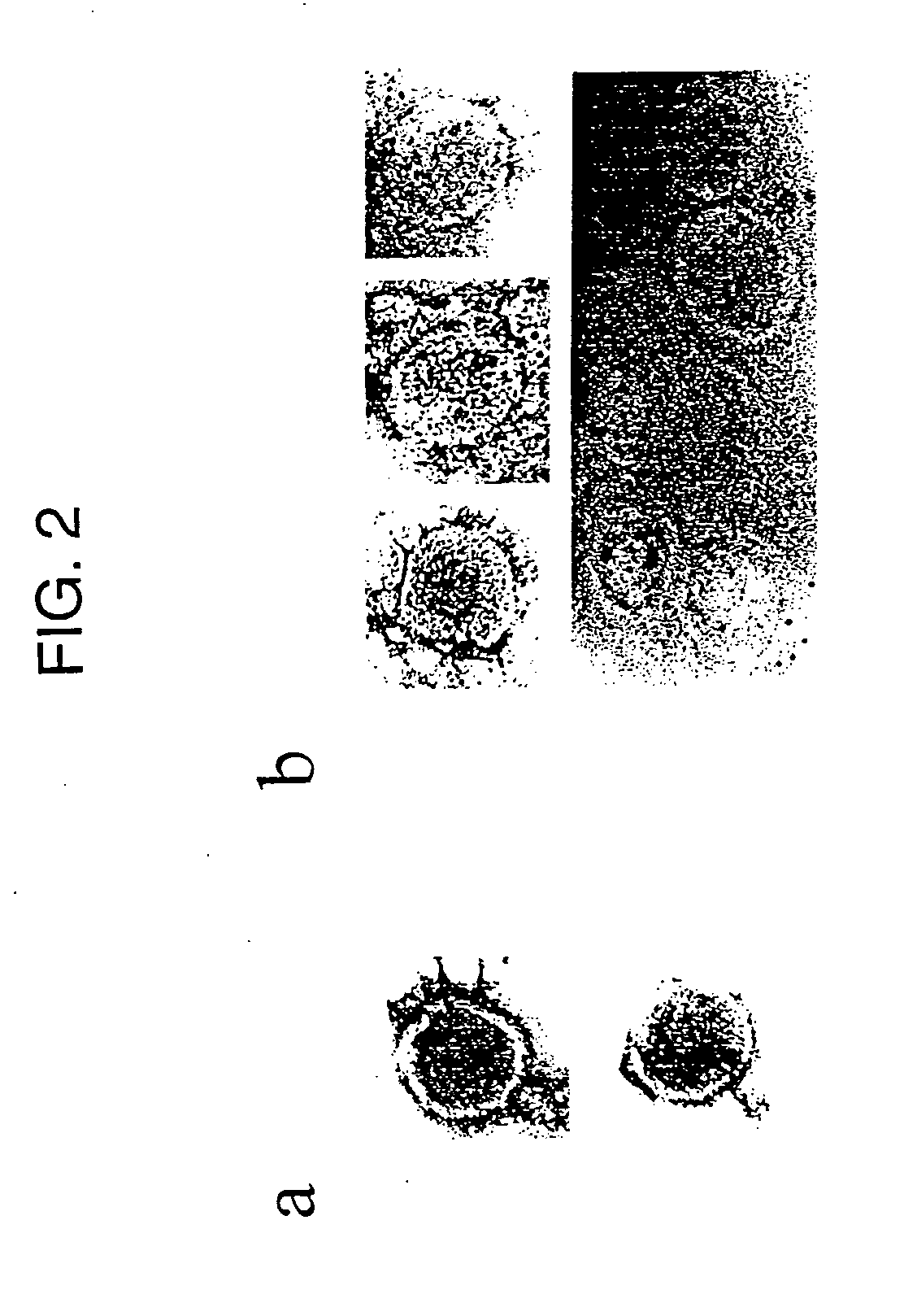 Polynucleotide Fragments of an Infectious Human Endogenous Retrovirus