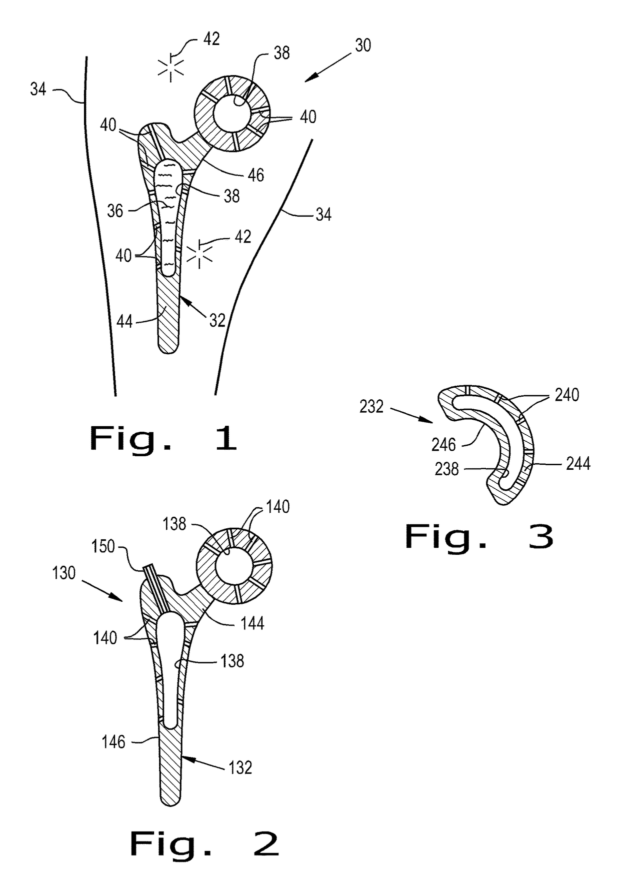 Drug delivery implants