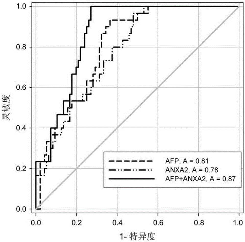 Blood serum detection method of annexin A2 as well as detection kit and application thereof