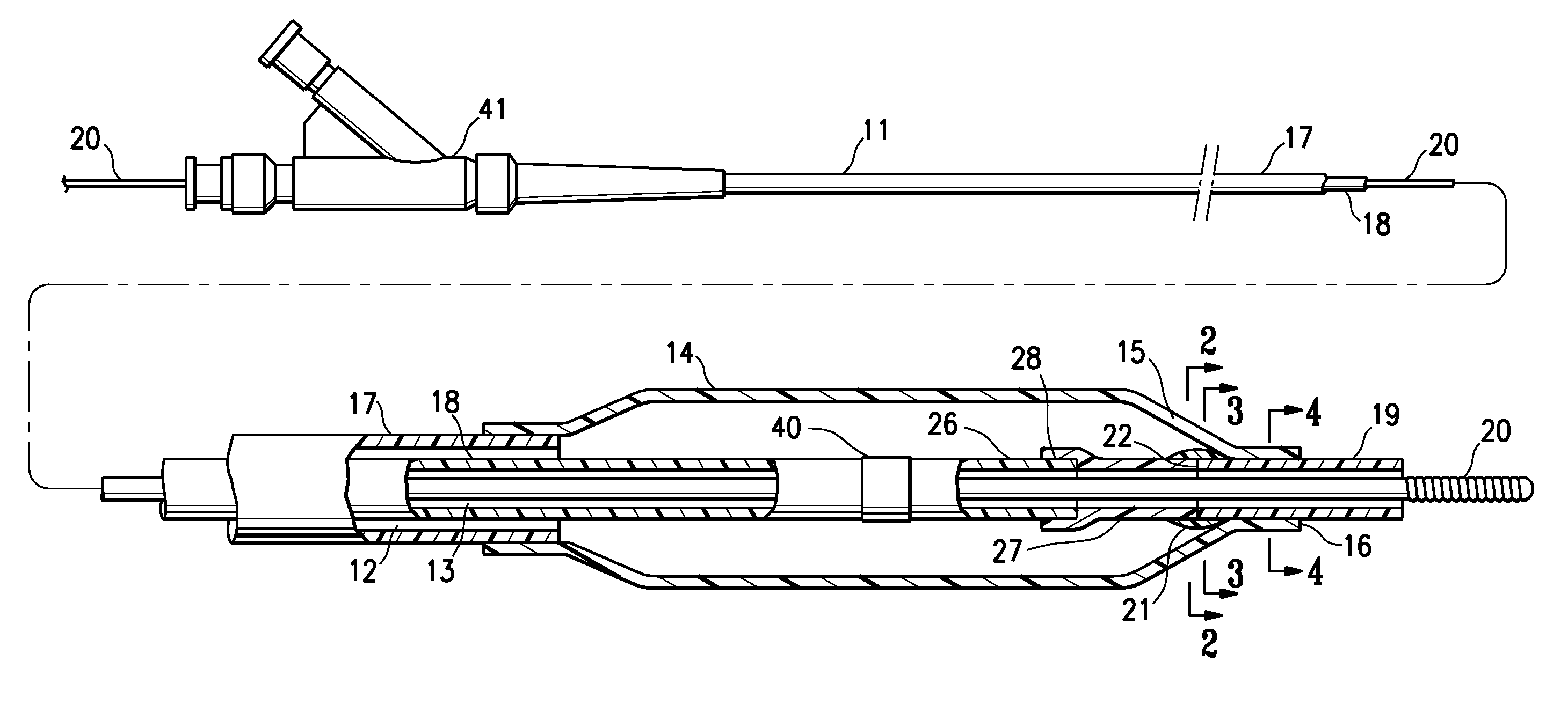 Catheter having transitioning shaft segments