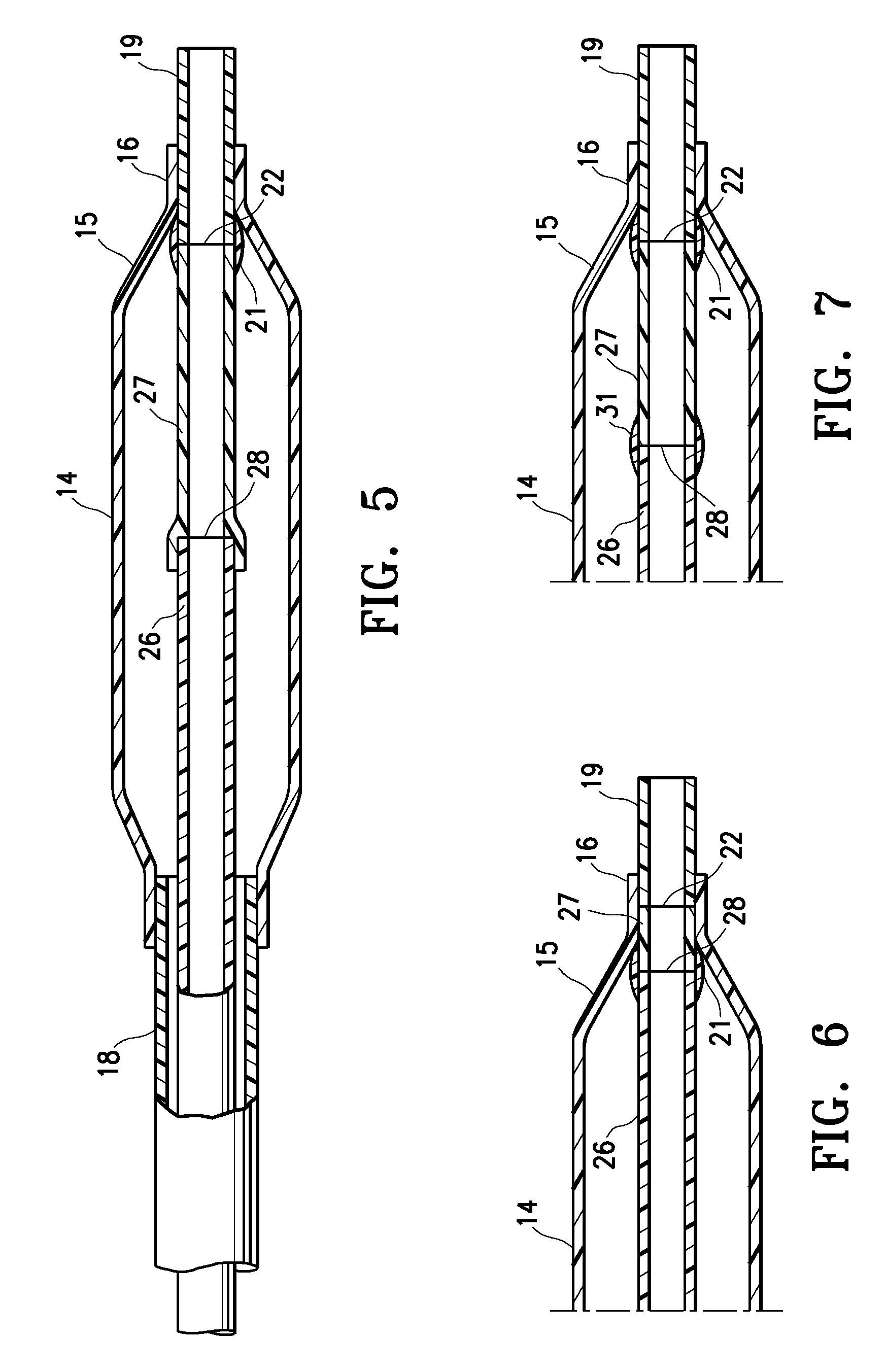 Catheter having transitioning shaft segments