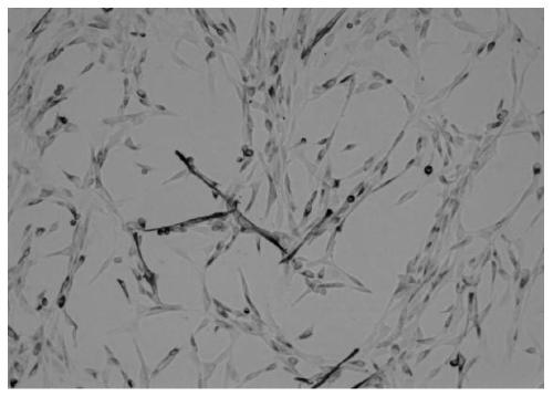 Skeletal muscle stem cell serum-free medium and its preparation method and application