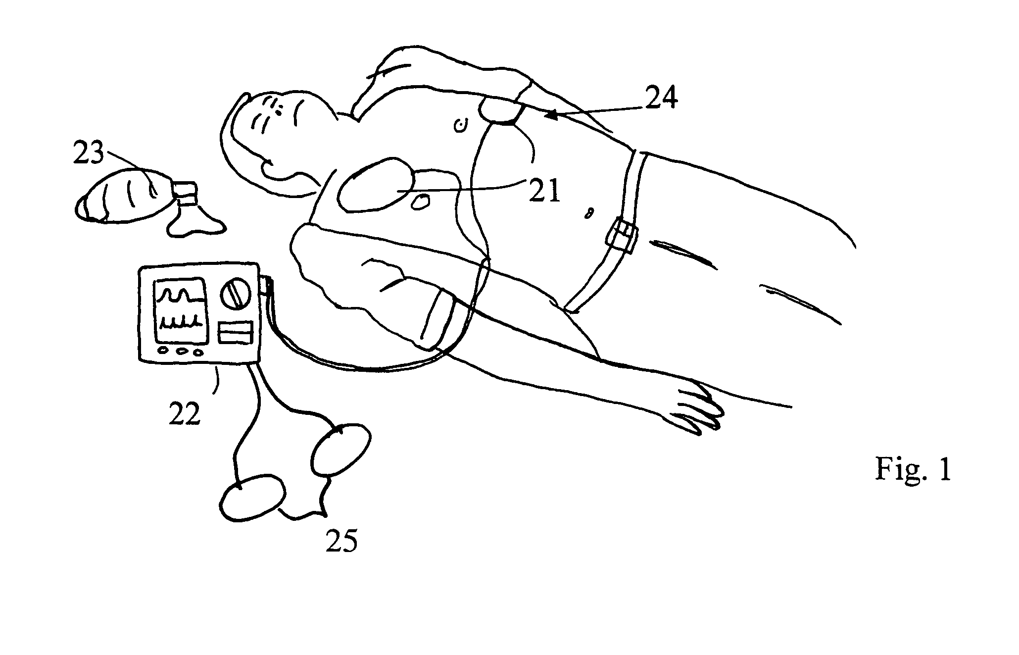 Method and system to determine correct tube placement during resuscitation