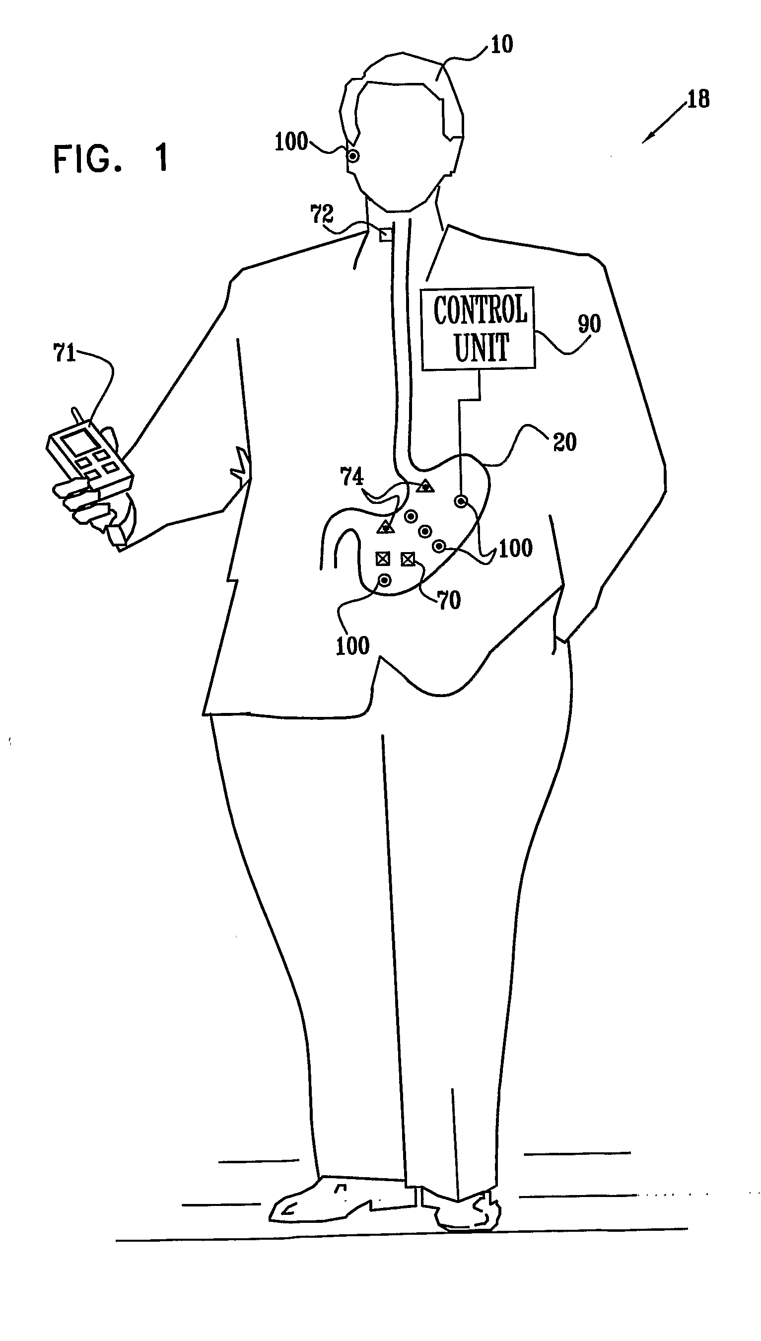 GI Lead Implantation