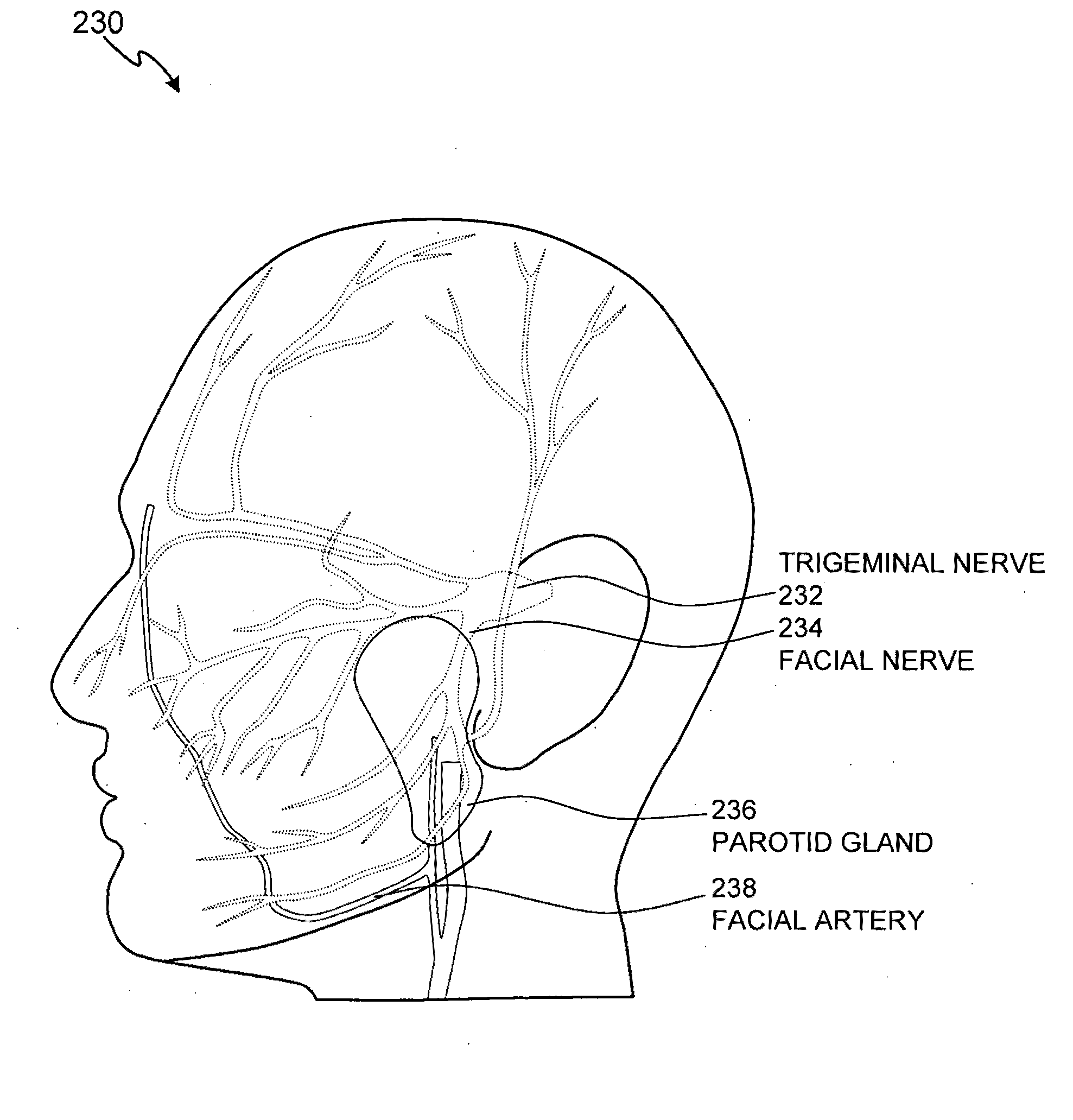 Noninvasive aesthetic treatment for tightening tissue