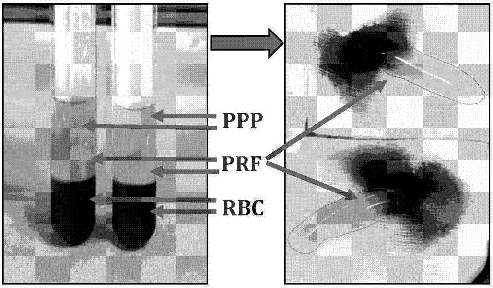 Amplification culture method for cloning adipose mesenchymal stem cells