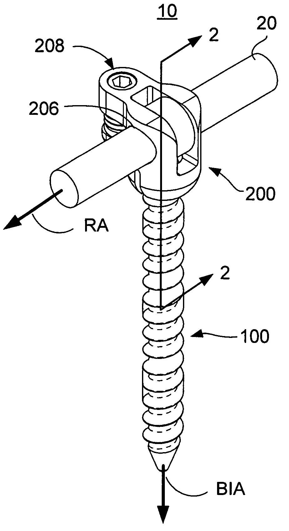 Spinal stabilization using bone anchor seat and cross coupling with improved locking feature