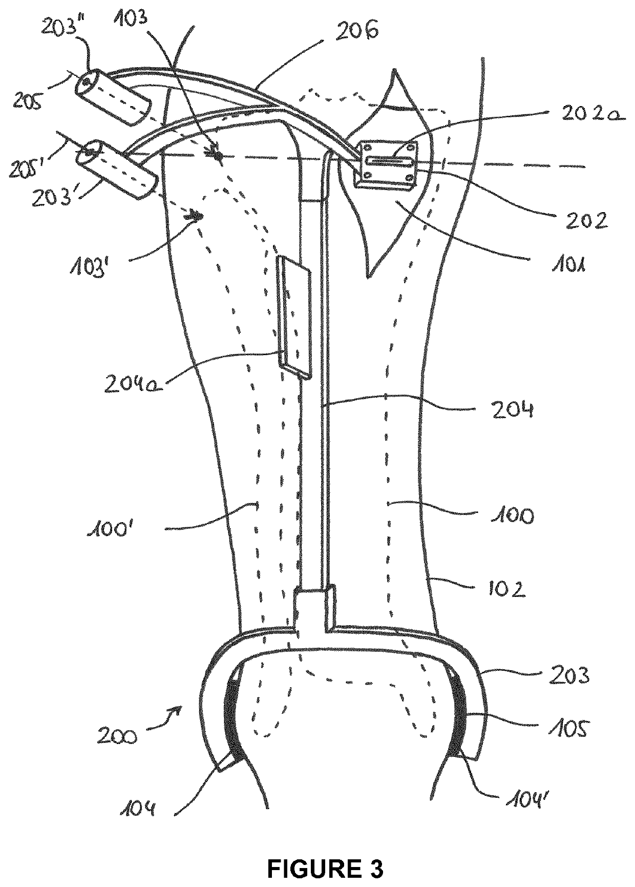 Patient-specific surgical guide