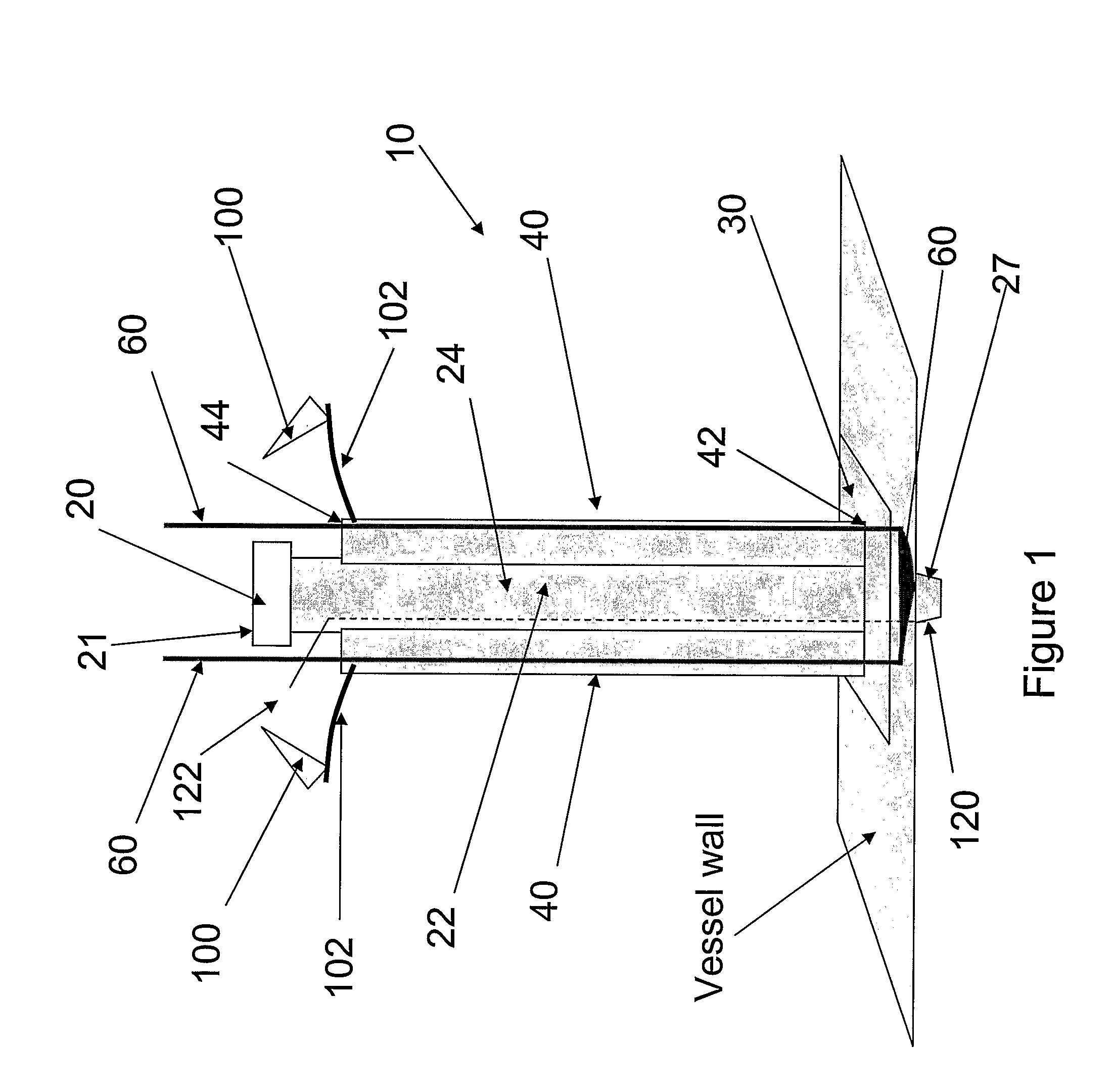 Cardioplegia Catheter System