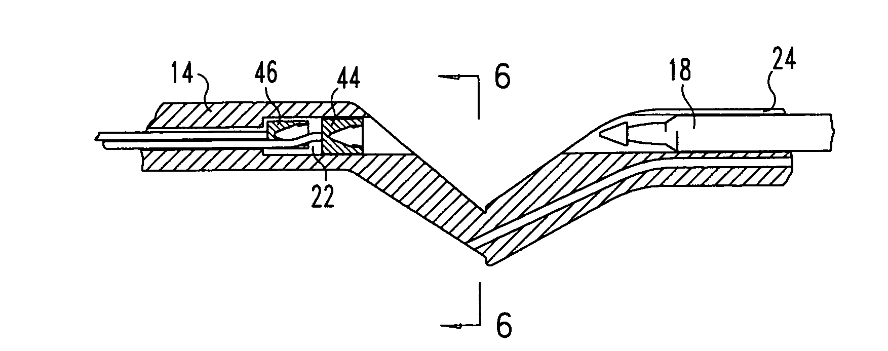 Vascular suturing device