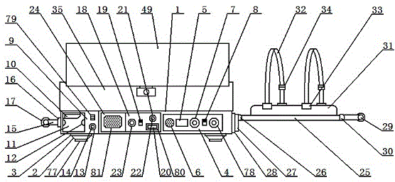 Temperature-adjustable children transfusion fixing device