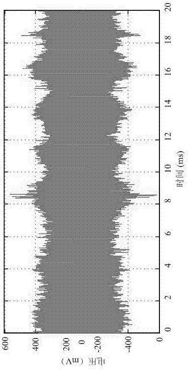 A Feature Extraction Method for Partial Discharge of XLPE High Voltage Cable