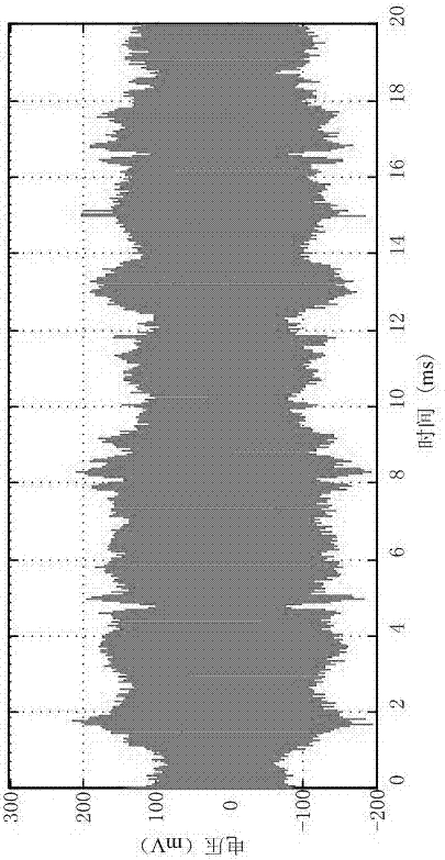 A Feature Extraction Method for Partial Discharge of XLPE High Voltage Cable