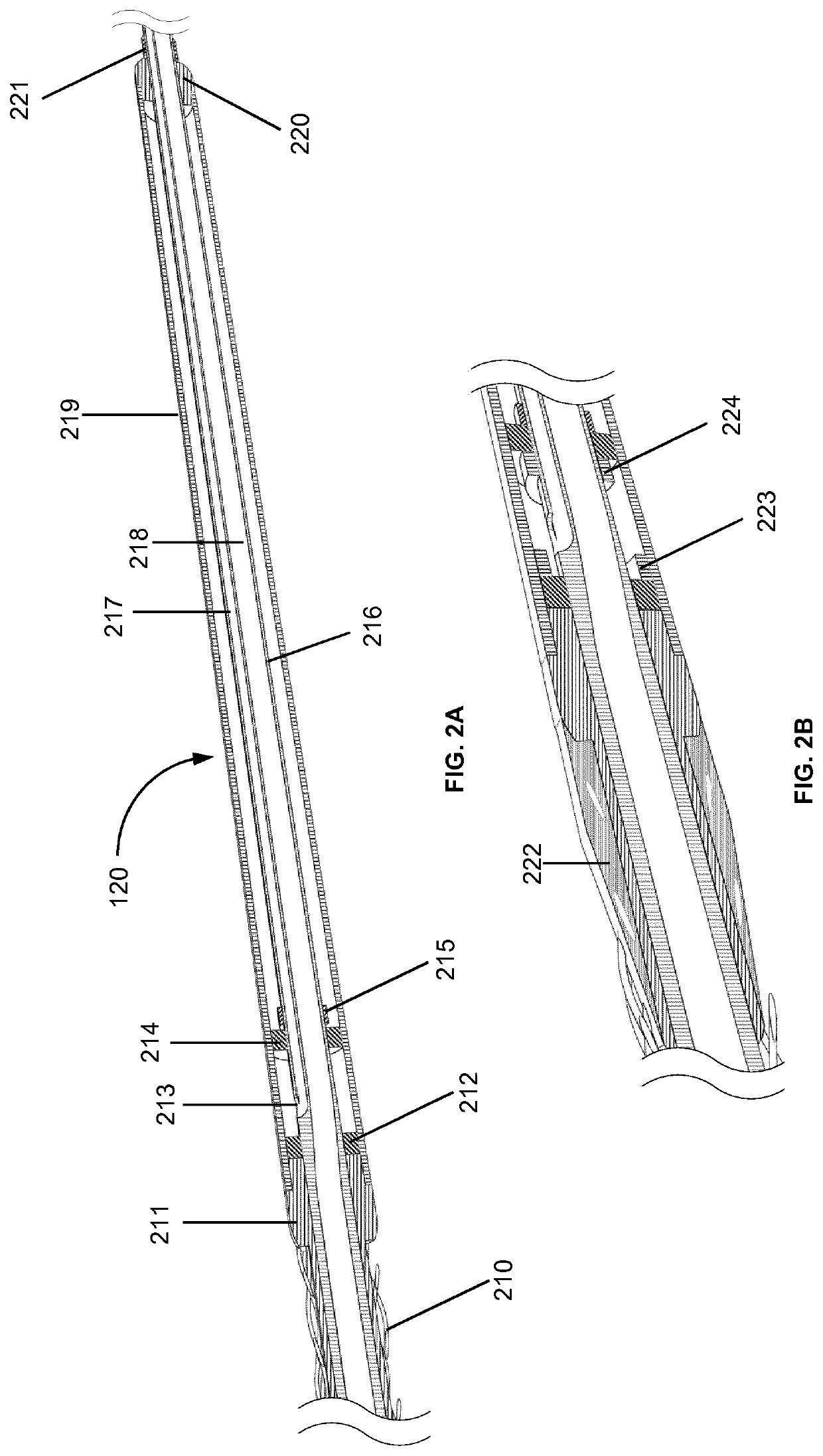 Catheter system for treating vascular and non-vascular diseases