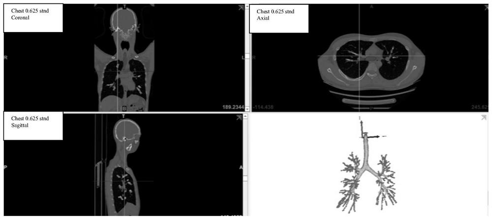 Construction method of human body full-airway model with random characteristics