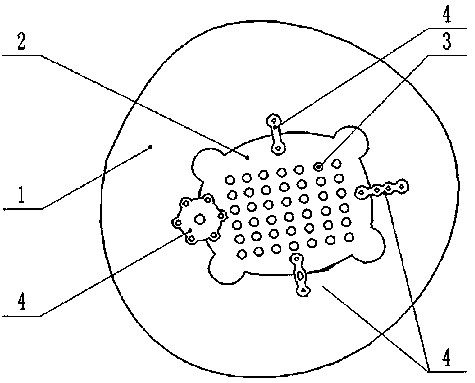 Bone plate for human skull defect repair and preparing method and using method of bone plate