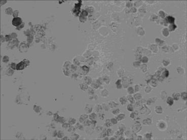 In-situ hybridization assay kit for mRNA level of premalignant CDK8 (cyclin-dependent kinase 8) as well as assay method and application