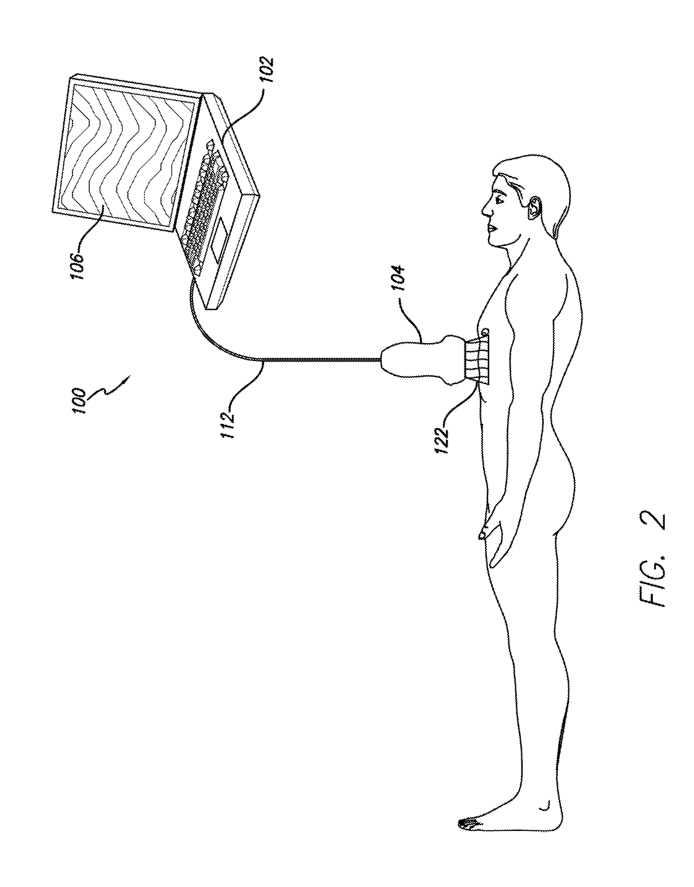 Embedded Motion Sensing Technology for Integration within Commercial Ultrasound Probes