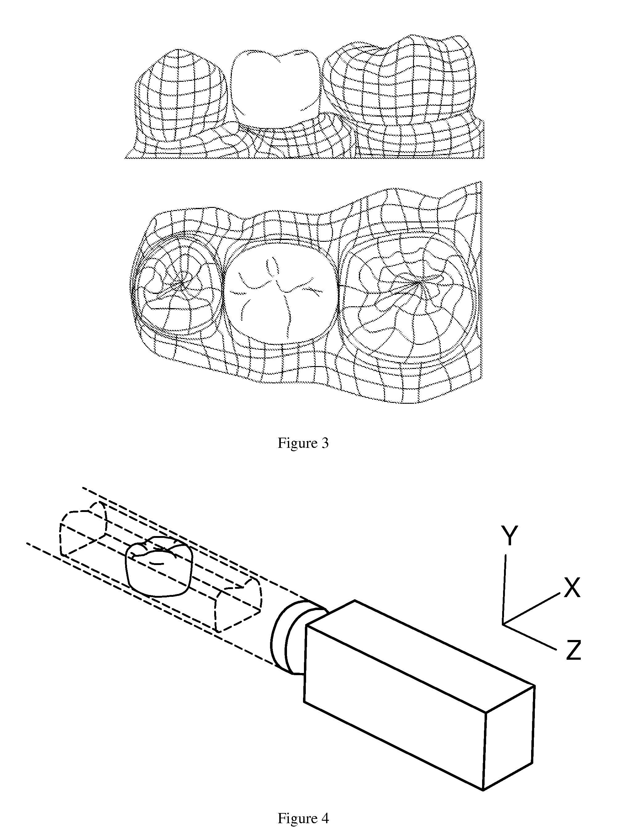 Augmented reality system for a dental laboratory