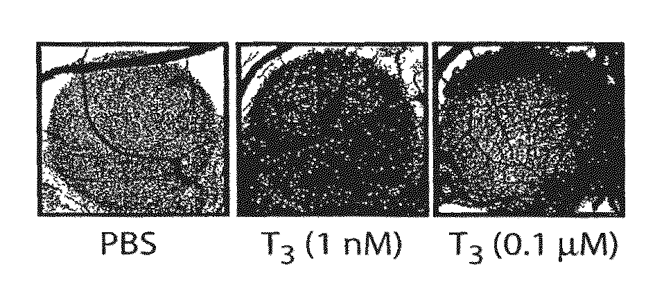 Thyroid hormone analogs and methods of use