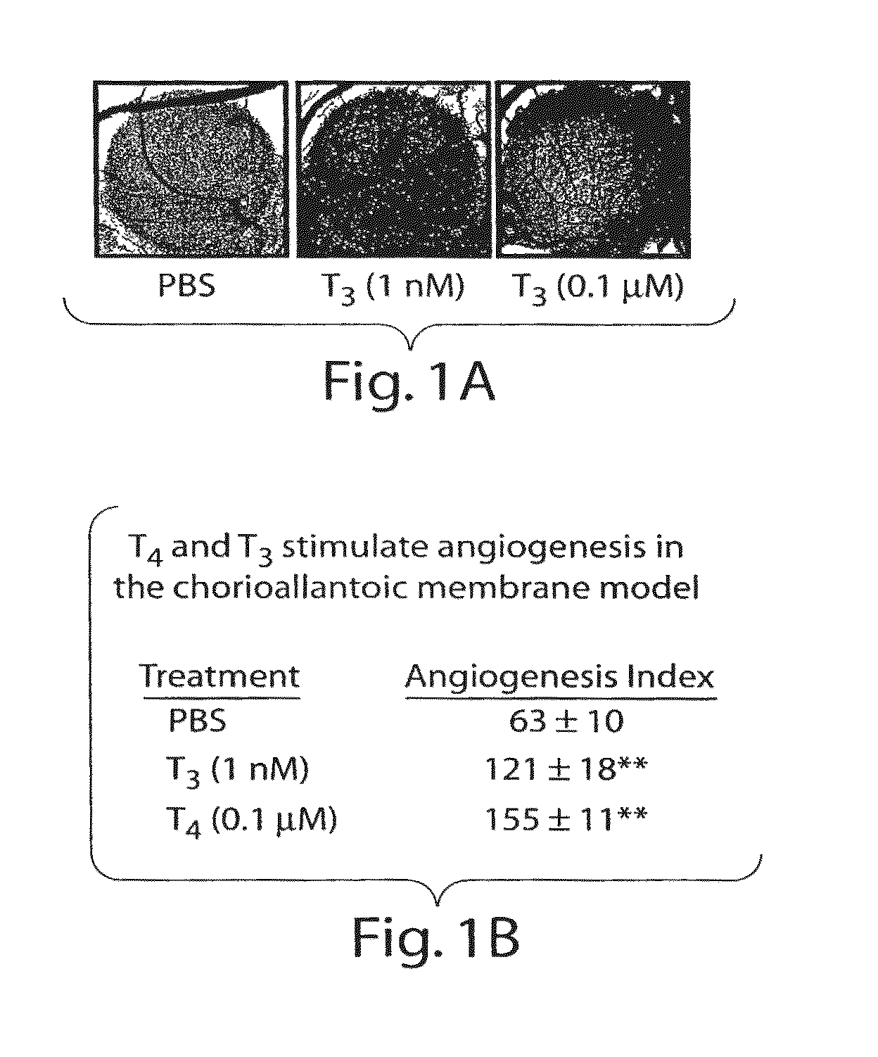 Thyroid hormone analogs and methods of use