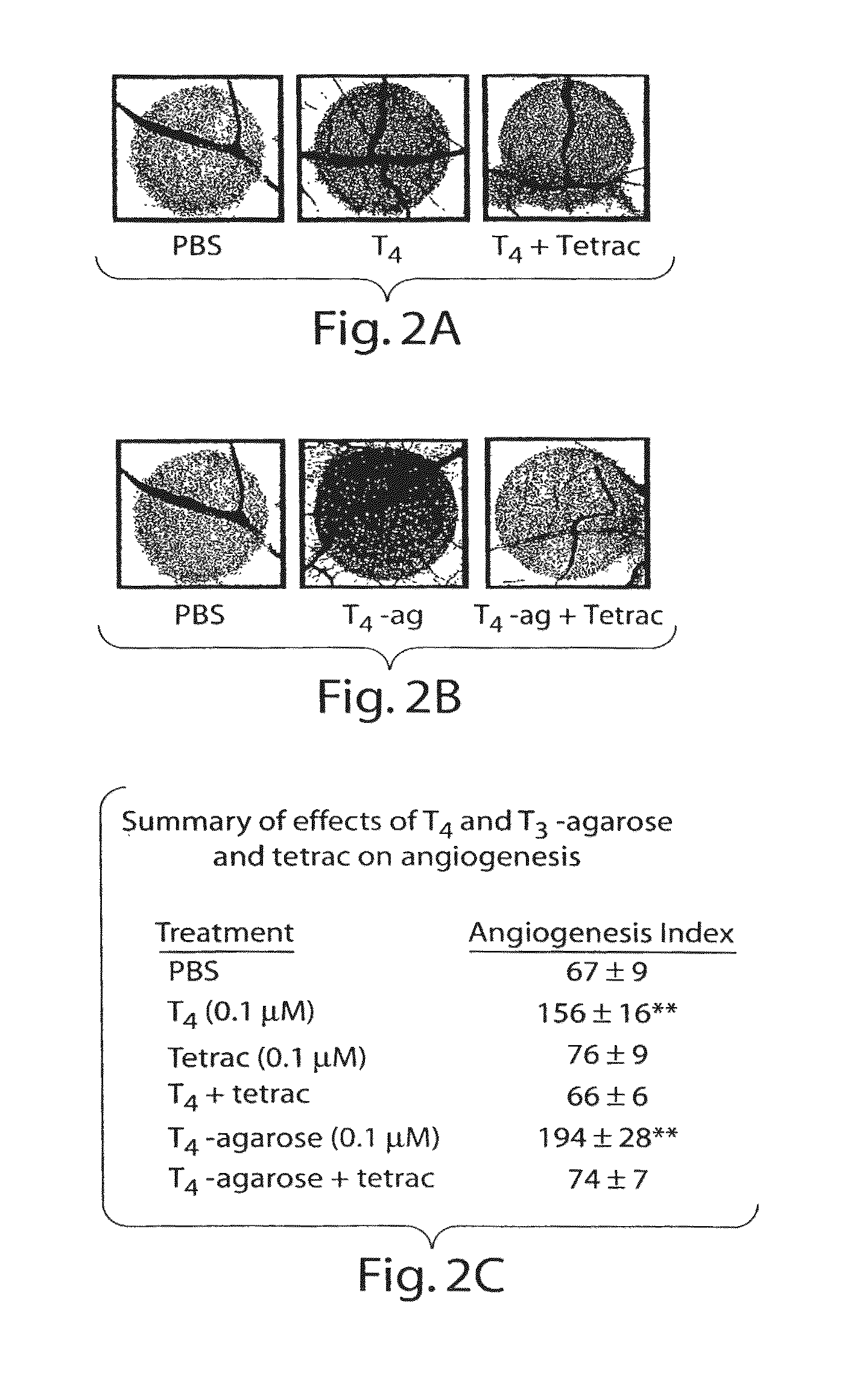 Thyroid hormone analogs and methods of use