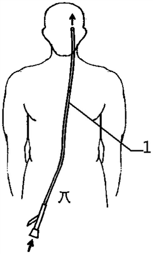 A kind of hypothermia cerebral protection interventional catheter and preparation method thereof