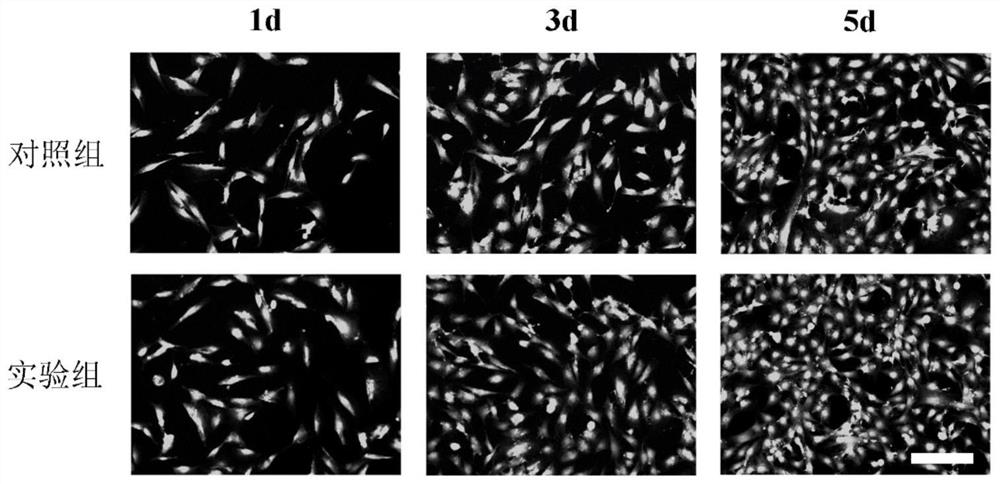 Electroactive perovskite hydrogel suitable for electrical stimulation bone regeneration as well as preparation and application of electroactive perovskite hydrogel