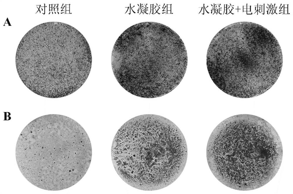 Electroactive perovskite hydrogel suitable for electrical stimulation bone regeneration as well as preparation and application of electroactive perovskite hydrogel