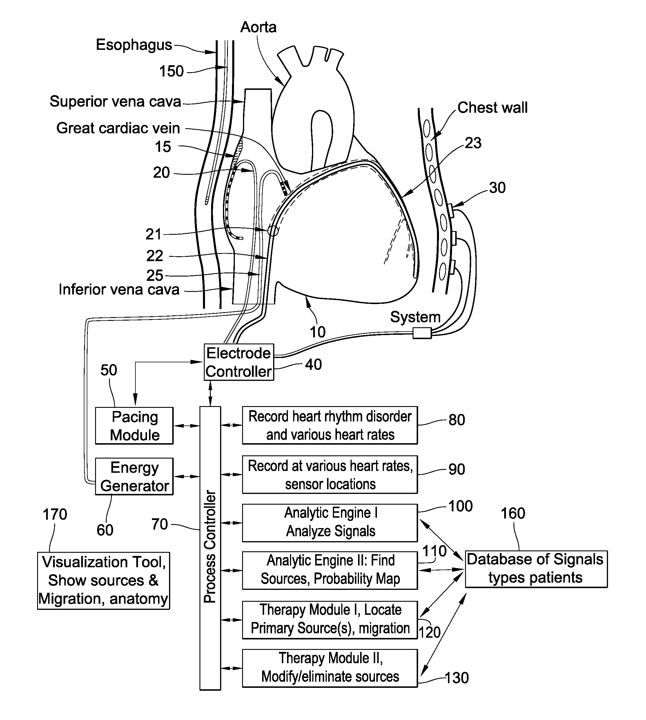 Methods, system and apparatus for the detection, diagnosis and treatment of biological rhythm disorders