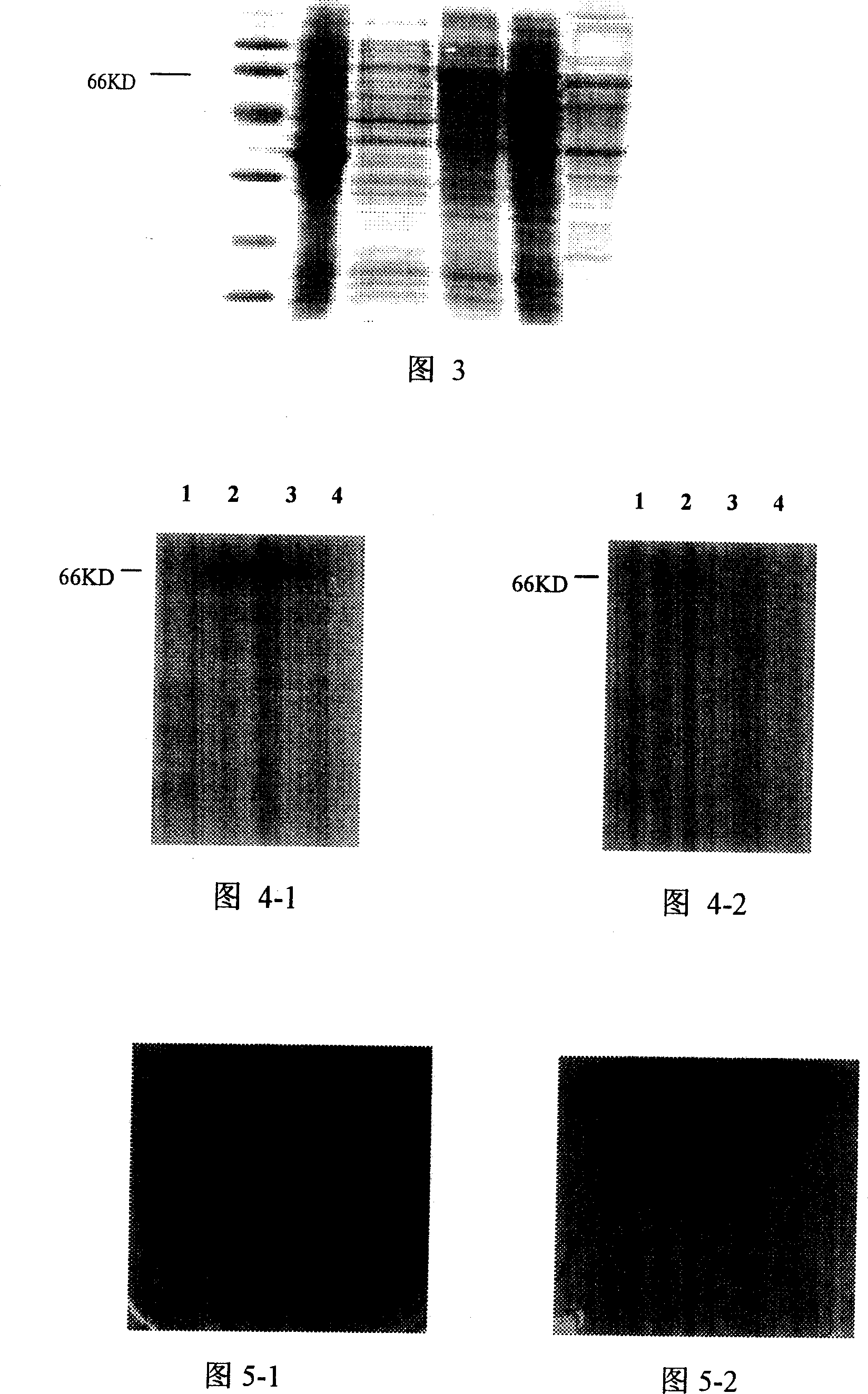 Fusion expressed product of vascular inhibine and endostatin in colibacillus and its preparing method