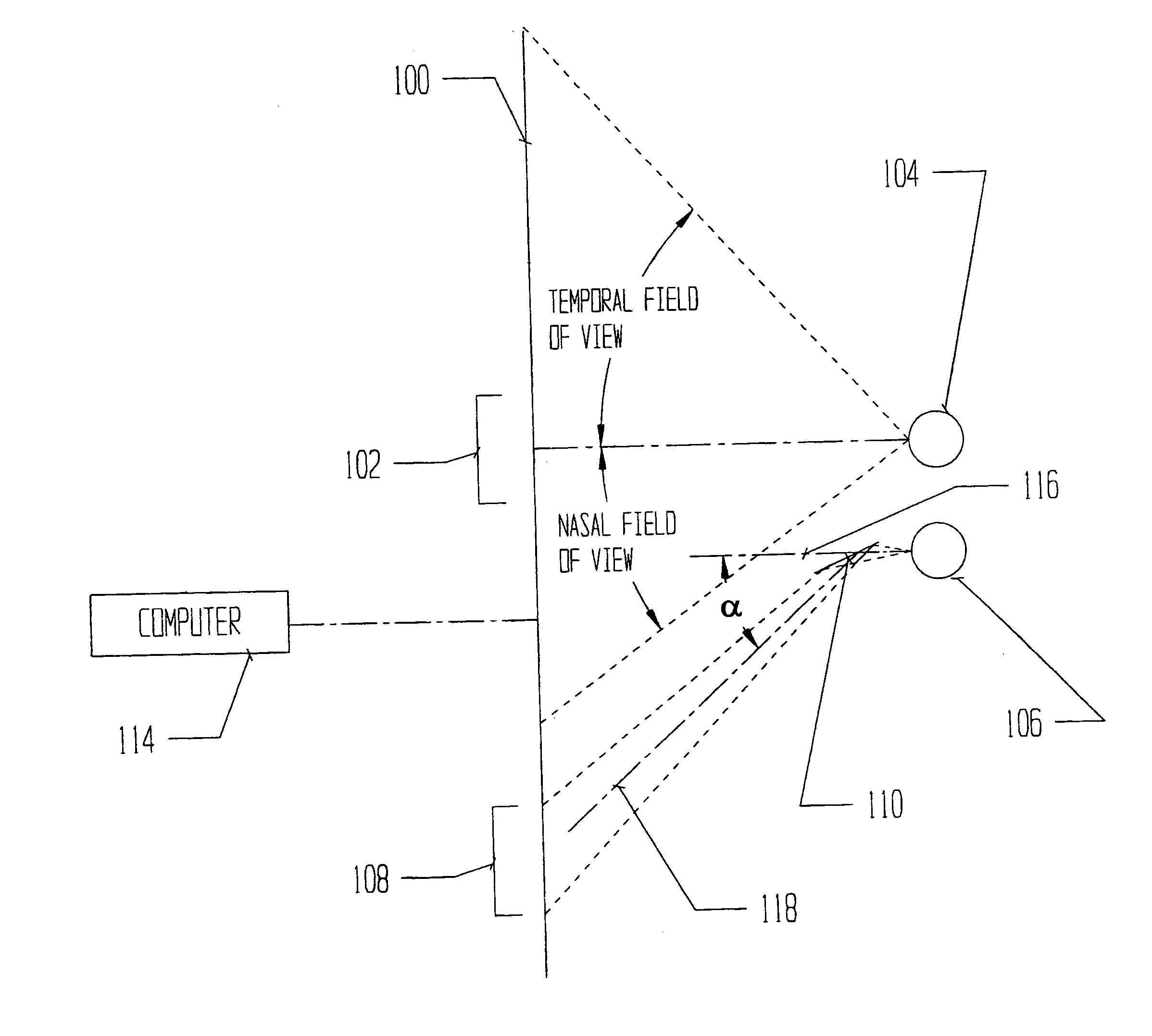 Automated stereocampimeter and related method for improved measurement of the visual field