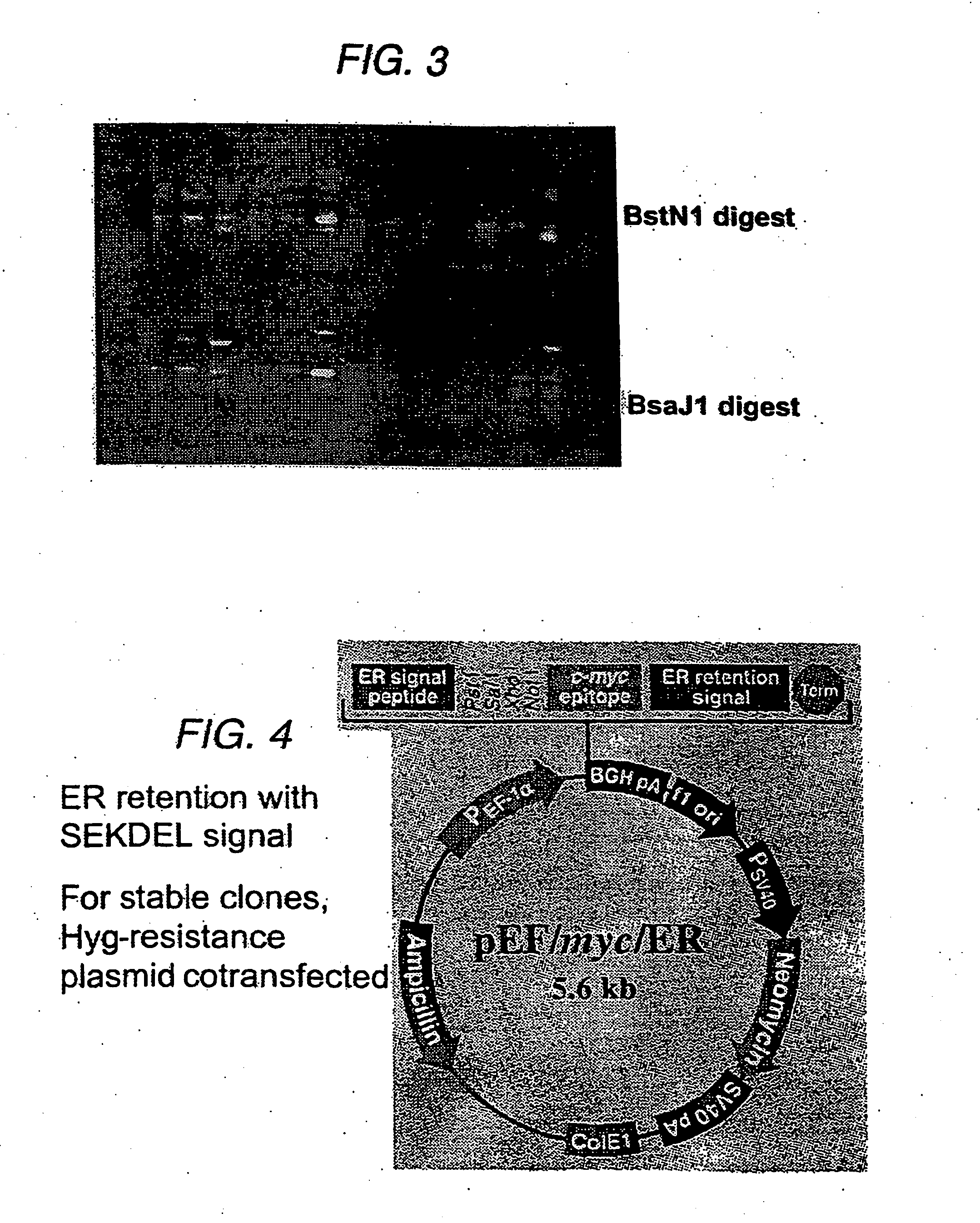 Suppression of xenotransplant rejection