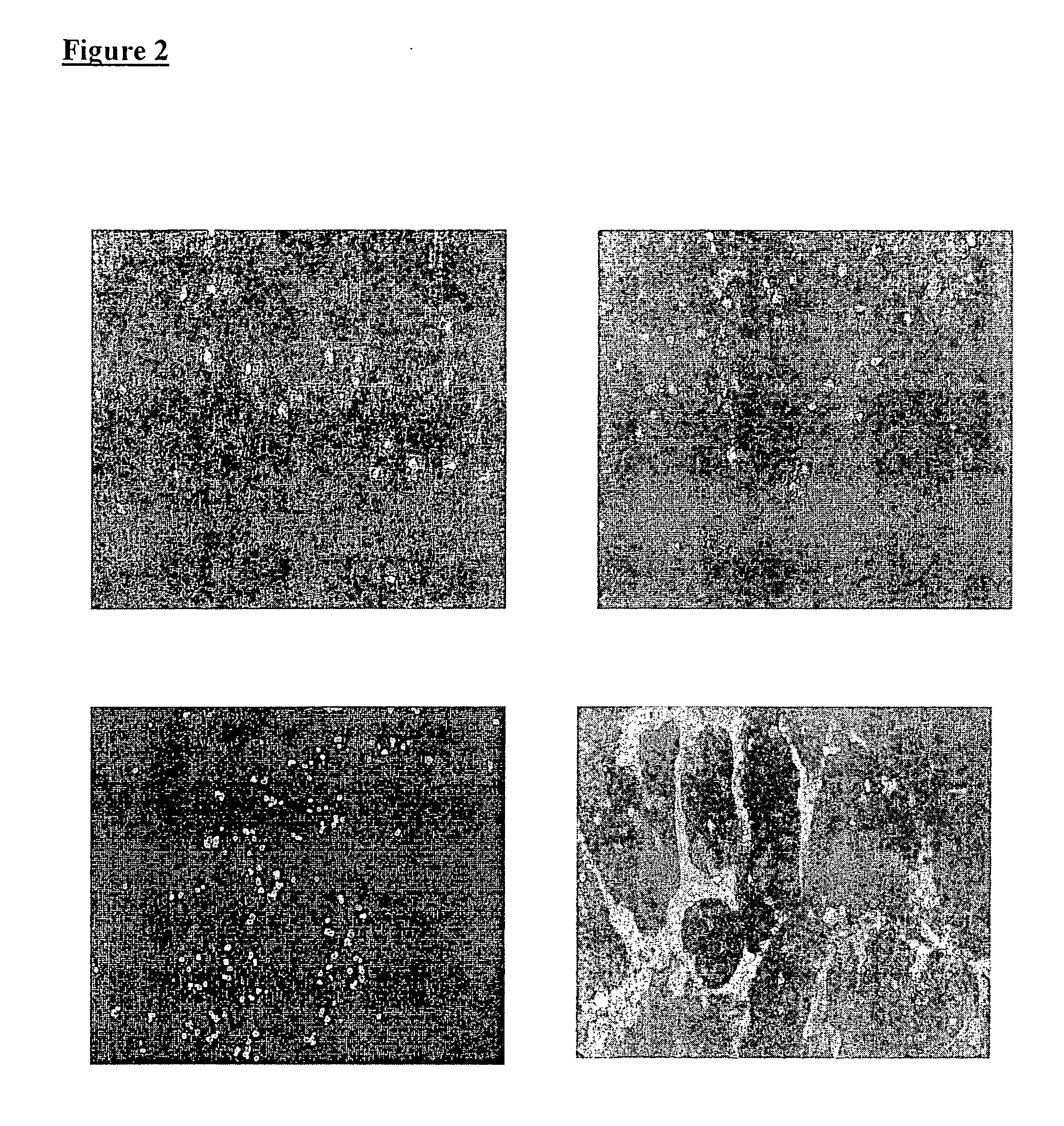 Anti-EGFR antibody therapy based on an increased copy number of the EGFR gene in tumor tissues