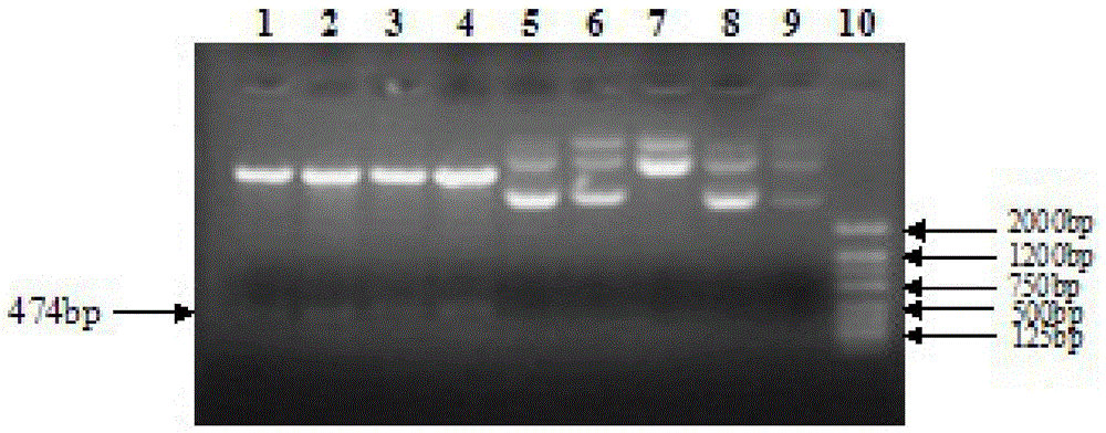 Human thymosin β4 triploid protein, coding gene and separation and purification method thereof